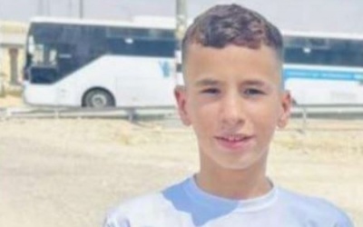 إصابة فتى برصاص الاحتلال في بلدة سلوان